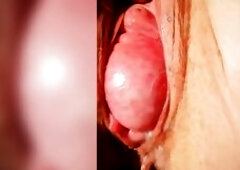 playing with clitoris prolapse pussy