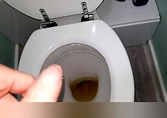 YELLOW URINATE FROM MY FAT KNOB