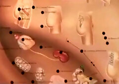 Porno argentino- Sesión de acupuntura