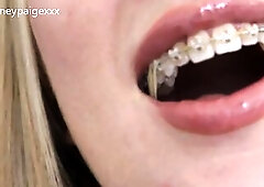 Sydney Paige Teases U to Cum All Over Her Braces