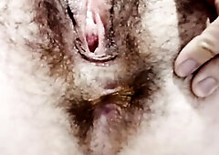 Livecam show, shaggy cunt, large vagina, large twat lips, hirsute butthole, striptease, closeups, distant sex online. Hirsute Ukrainian mother i'