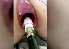 Gaping anal being screwed unfathomable by screw machine